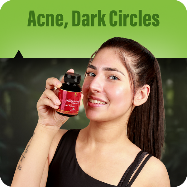 Acne, Dark Circles